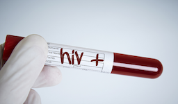 HIV And Mental Health
